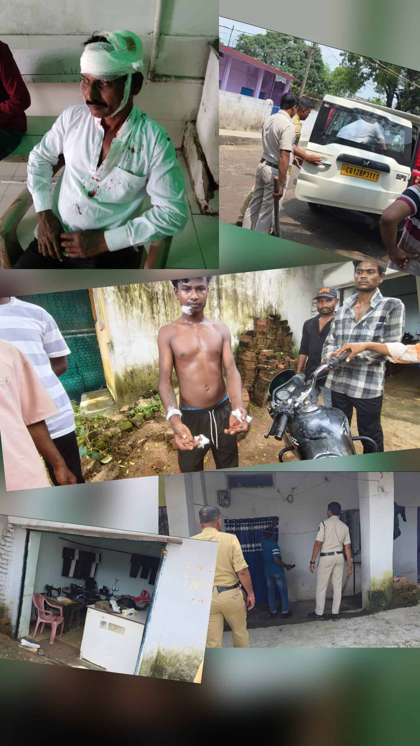 कोरबा: पुरानी रंजिश में टेलर पर हमला, बीच-बचाव करने आए युवक का गाल काटा