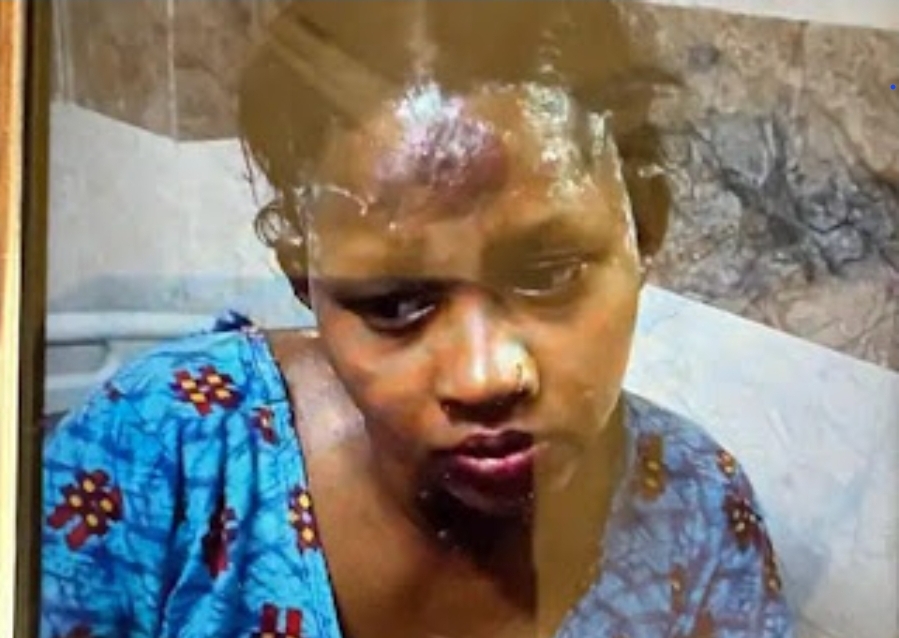 कोरबा: चरित्र संदेह में हैवानियत, पति ने पत्नी पर पेट्रोल डालकर जिंदा जलाया